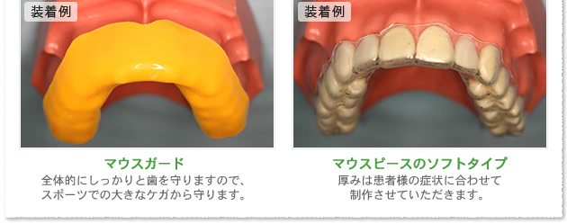 マウスガード・マウスピース